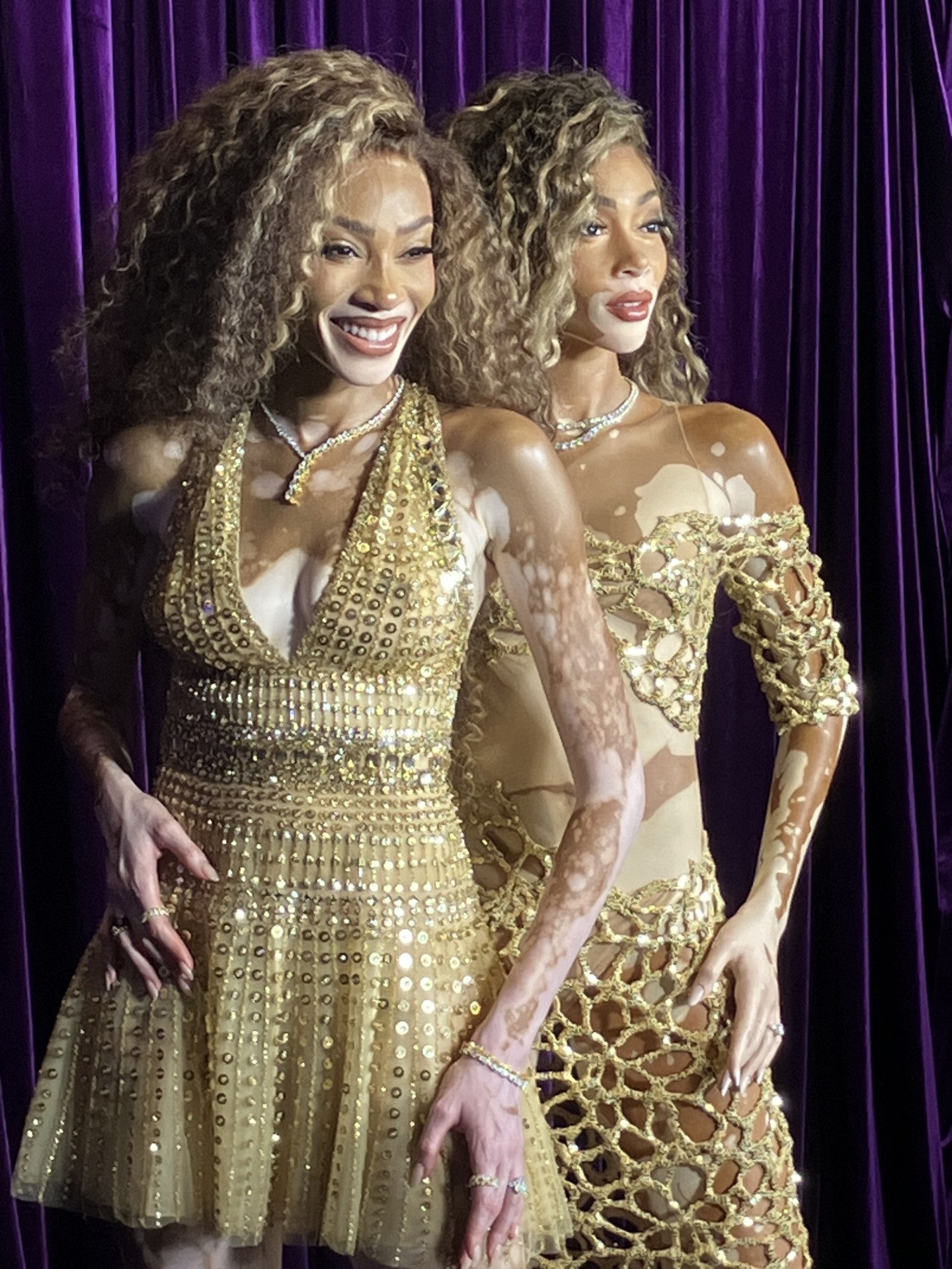 The real Winnie Harlow (left) and her wax figure at Madame Tussauds in New York